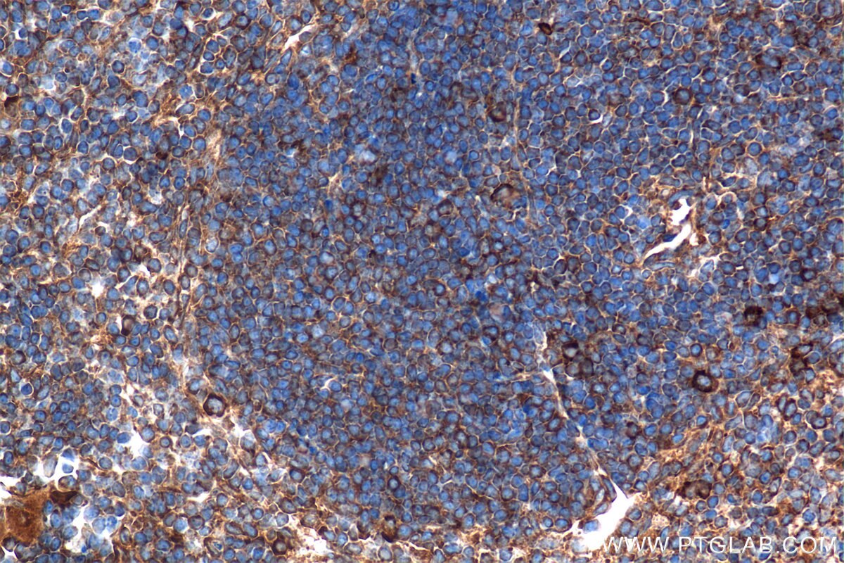 Immunohistochemical analysis of paraffin-embedded mouse spleen tissue slide using 80260-2-RR (Tnfa antibody) at dilution of 1:2000 (under 40x lens). This data was developed using the same antibody clone with 80260-2-PBS in a different storage buffer formulation. Immunohistochemistry (IHC) staining of mouse spleen tissue using TNF-alpha Recombinant monoclonal antibody (80260-2-RR)