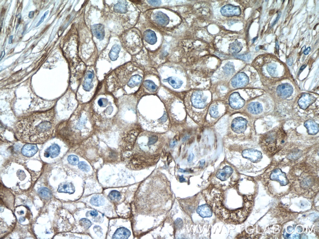 TNF Alpha Polyclonal antibody