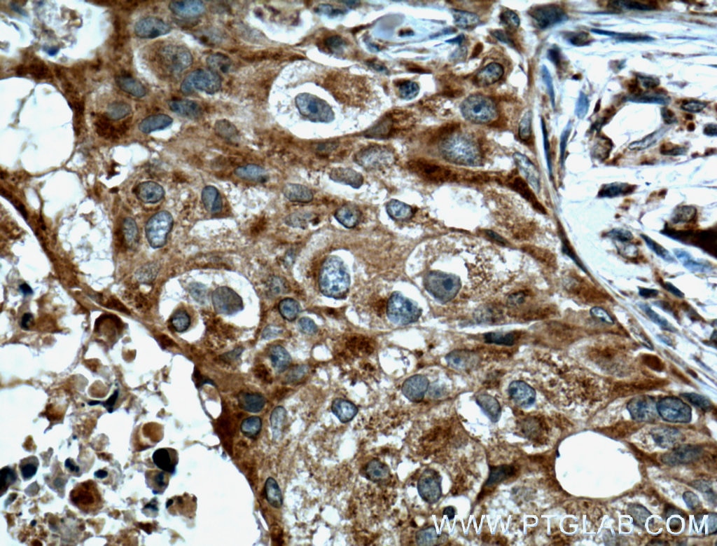 TNF Alpha Polyclonal antibody