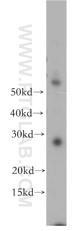 TNF Alpha Polyclonal antibody