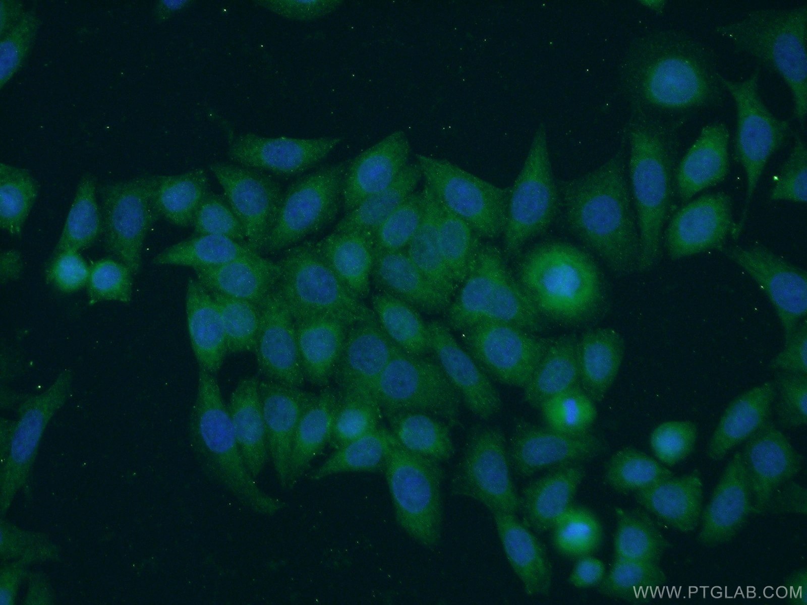 Immunofluorescence (IF) / fluorescent staining of HeLa cells using TNFAIP1 Polyclonal antibody (15320-1-AP)