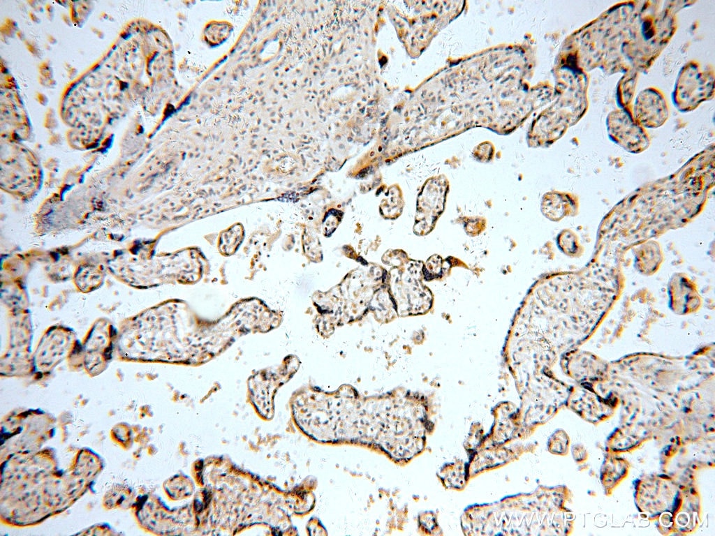Immunohistochemistry (IHC) staining of human placenta tissue using TNFAIP1 Polyclonal antibody (15320-1-AP)