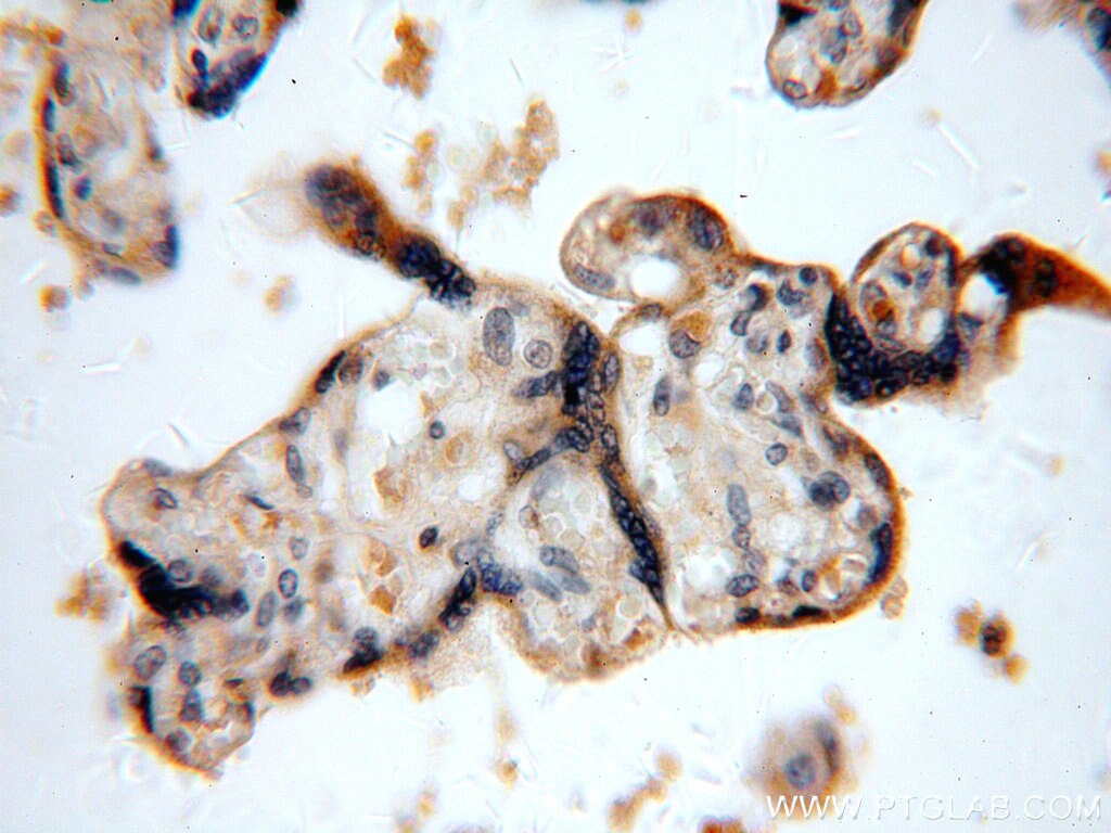 Immunohistochemistry (IHC) staining of human placenta tissue using TNFAIP1 Polyclonal antibody (15320-1-AP)