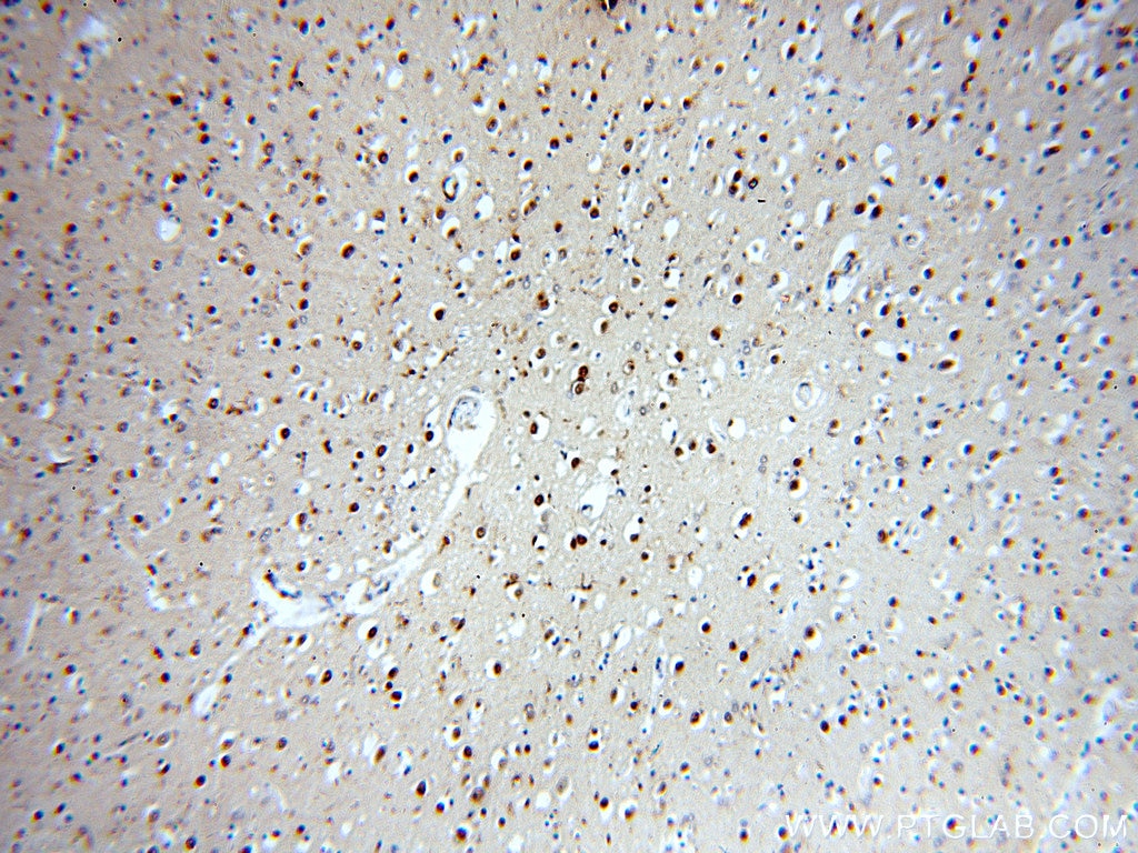 Immunohistochemistry (IHC) staining of human brain tissue using TNFAIP1 Polyclonal antibody (15320-1-AP)