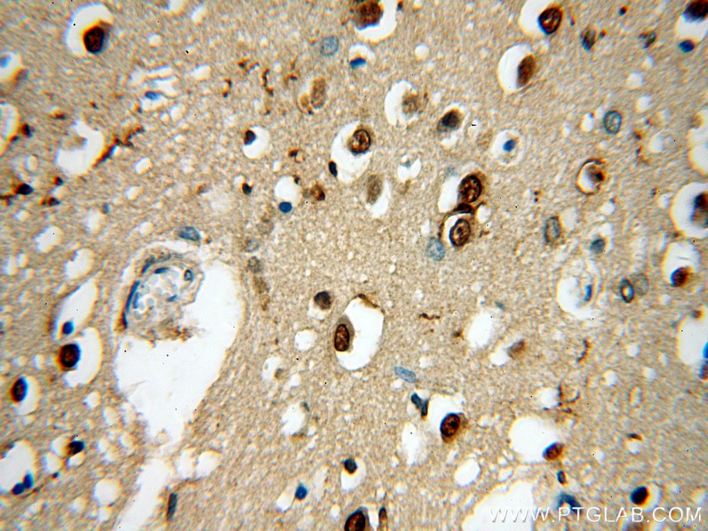 Immunohistochemistry (IHC) staining of human brain tissue using TNFAIP1 Polyclonal antibody (15320-1-AP)