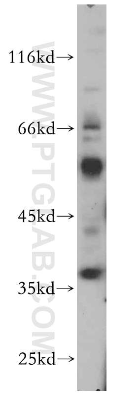 Western Blot (WB) analysis of L02 cells using TNFAIP1 Polyclonal antibody (15320-1-AP)