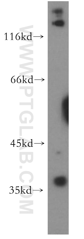 Western Blot (WB) analysis of HeLa cells using TNFAIP1 Polyclonal antibody (15320-1-AP)