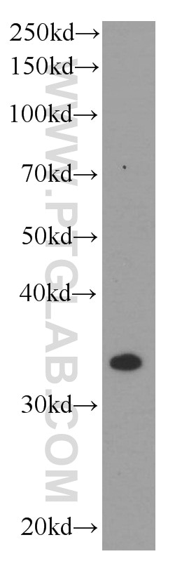 Western Blot (WB) analysis of HeLa cells using TNFAIP1 Monoclonal antibody (60327-1-Ig)