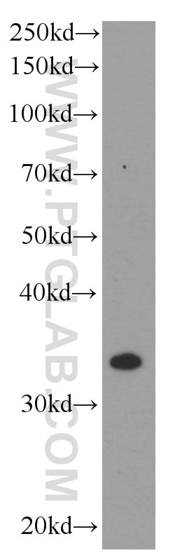 Western Blot (WB) analysis of HeLa cells using TNFAIP1 Monoclonal antibody (60327-1-Ig)