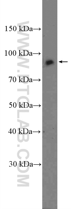 Western Blot (WB) analysis of Jurkat cells using TNFAIP3 Polyclonal antibody (23456-1-AP)