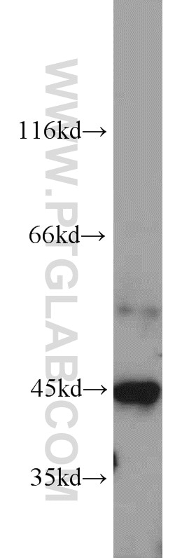 Western Blot (WB) analysis of Jurkat cells using TNFAIP3 Polyclonal antibody (23456-1-AP)