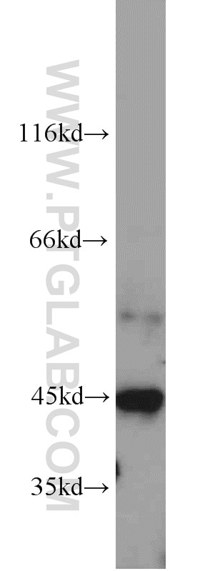 WB analysis of Jurkat using 23456-1-AP
