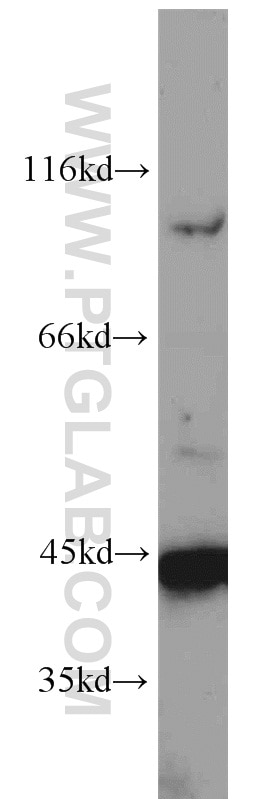 Western Blot (WB) analysis of HeLa cells using TNFAIP3 Polyclonal antibody (23456-1-AP)