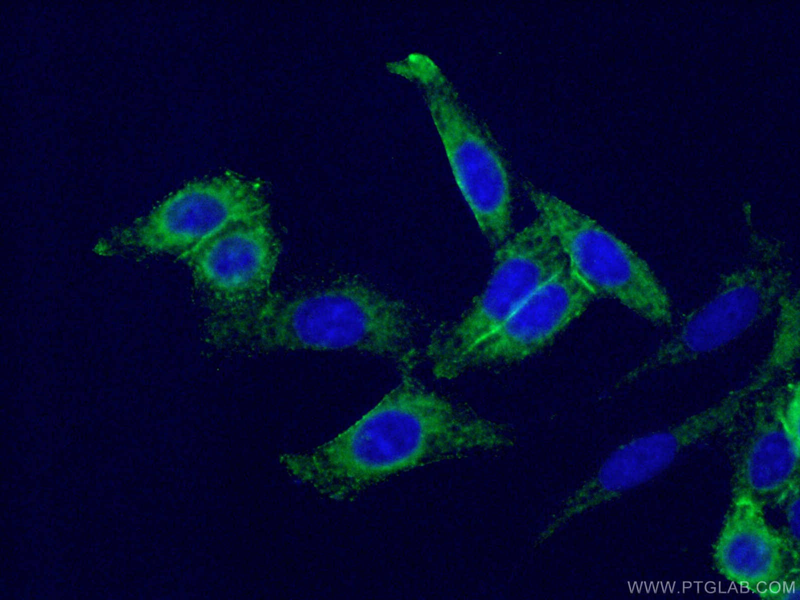 Immunofluorescence (IF) / fluorescent staining of HeLa cells using TNFAIP3 Monoclonal antibody (66695-1-Ig)