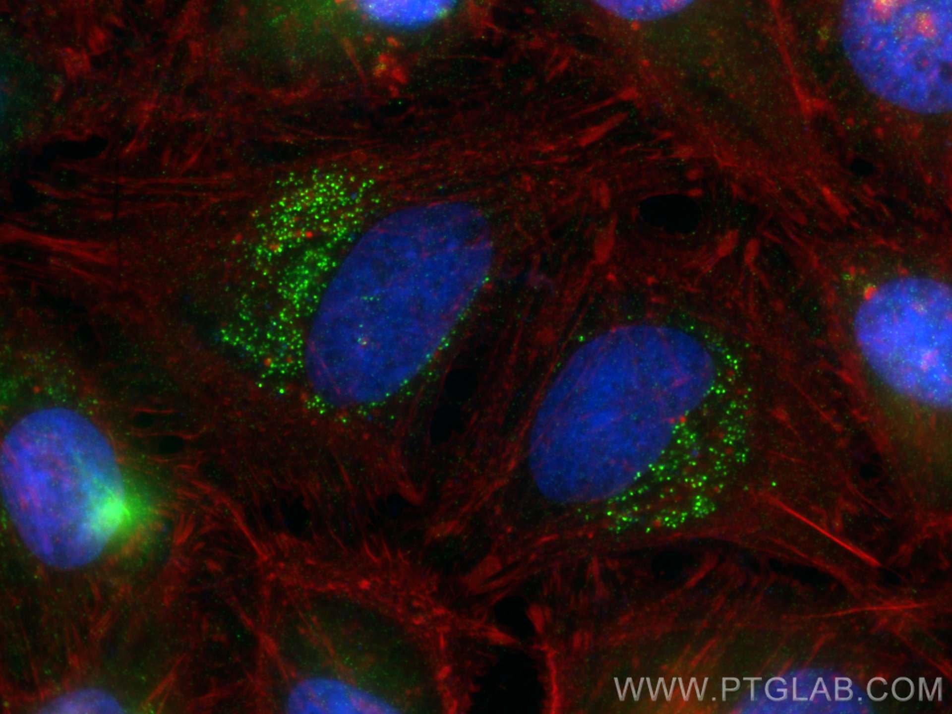 Immunofluorescence (IF) / fluorescent staining of HeLa cells using TNFAIP3 Monoclonal antibody (66695-1-Ig)