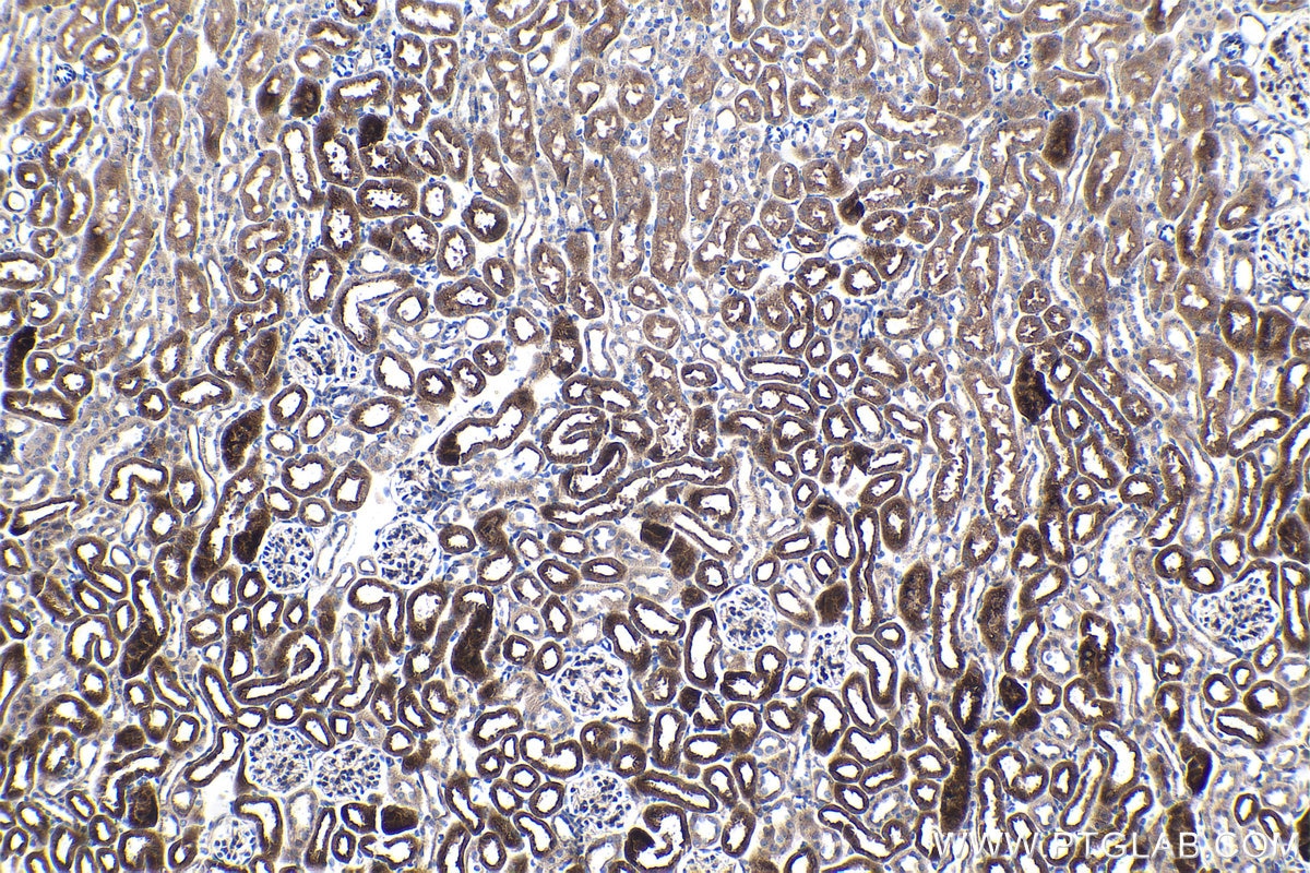 Immunohistochemistry (IHC) staining of mouse kidney tissue using TNFAIP3 Monoclonal antibody (66695-1-Ig)