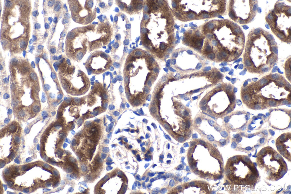 IHC staining of mouse kidney using 66695-1-Ig