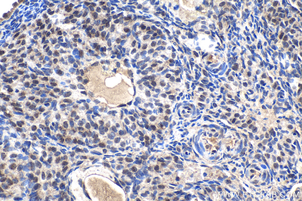 Immunohistochemistry (IHC) staining of rat ovary tissue using TNFAIP3 Monoclonal antibody (66695-1-Ig)