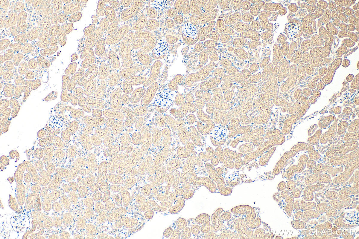 Immunohistochemistry (IHC) staining of mouse kidney tissue using TNFAIP3 Monoclonal antibody (66695-1-Ig)