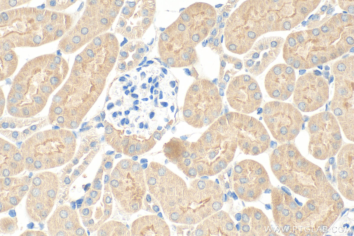 Immunohistochemistry (IHC) staining of mouse kidney tissue using TNFAIP3 Monoclonal antibody (66695-1-Ig)