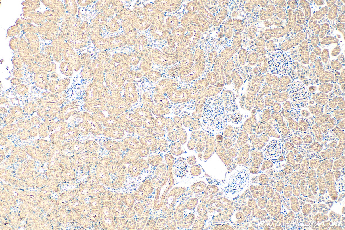 Immunohistochemistry (IHC) staining of rat kidney tissue using TNFAIP3 Monoclonal antibody (66695-1-Ig)