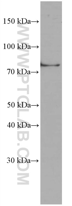 Western Blot (WB) analysis of HSC-T6 cells using TNFAIP3 Monoclonal antibody (66695-1-Ig)