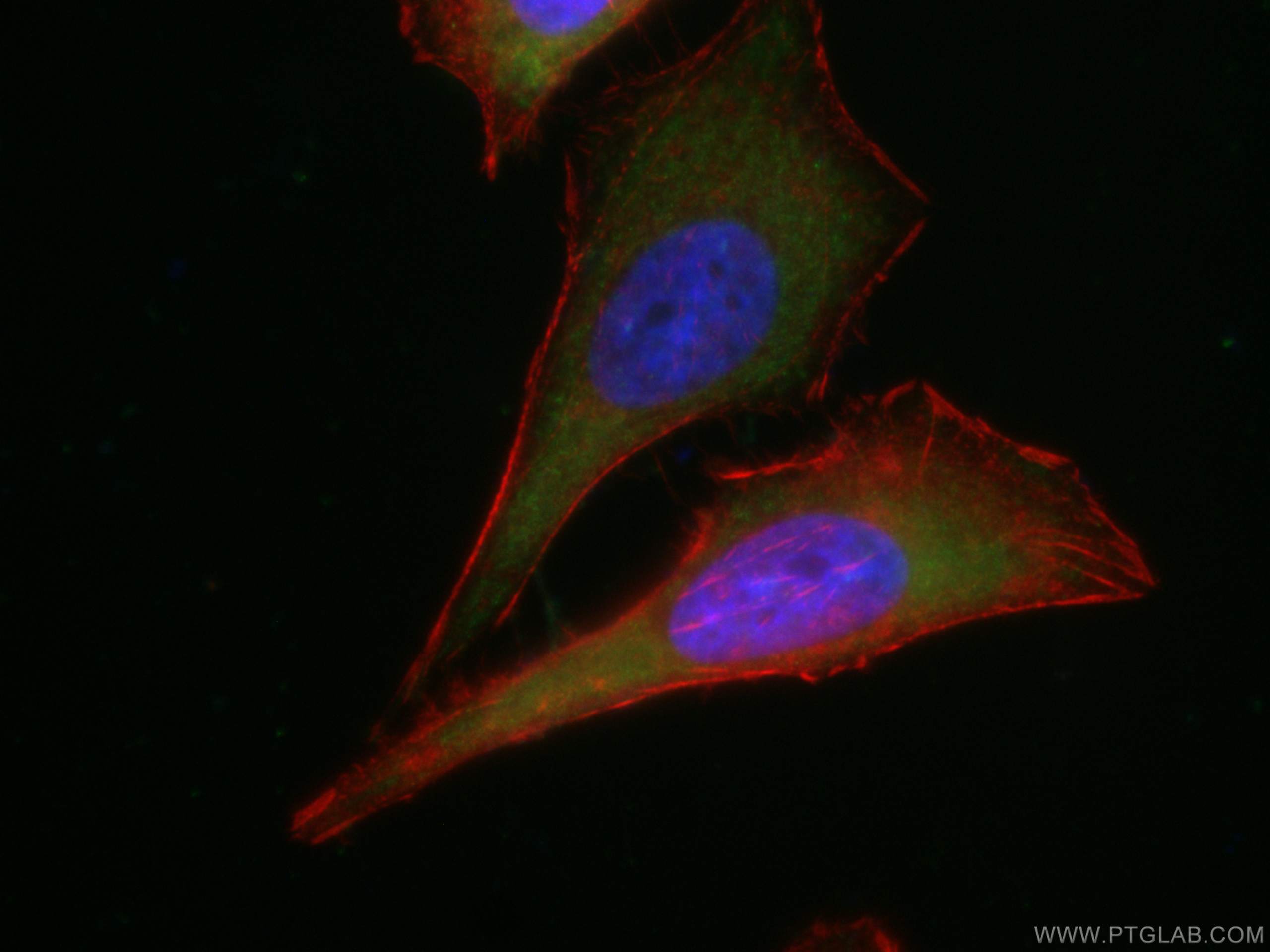 Immunofluorescence (IF) / fluorescent staining of HeLa cells using CoraLite® Plus 488-conjugated TNFAIP3 Monoclonal a (CL488-66695)