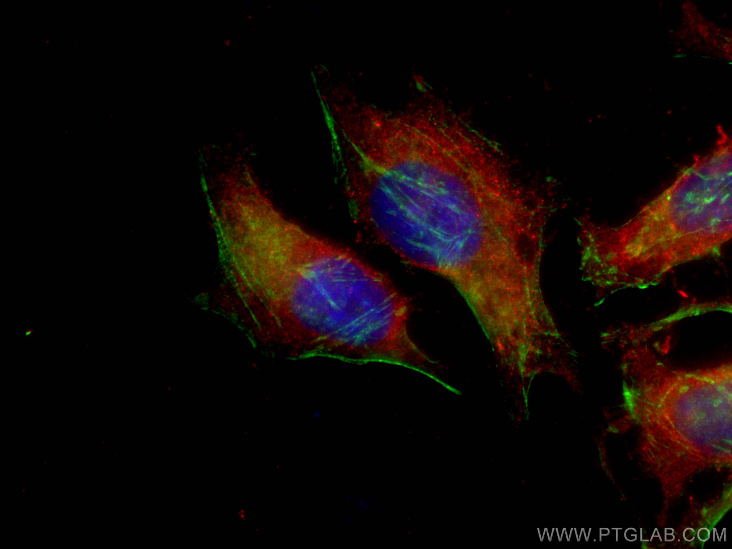 Immunofluorescence (IF) / fluorescent staining of HeLa cells using CoraLite®594-conjugated TNFAIP3 Monoclonal antibod (CL594-66695)