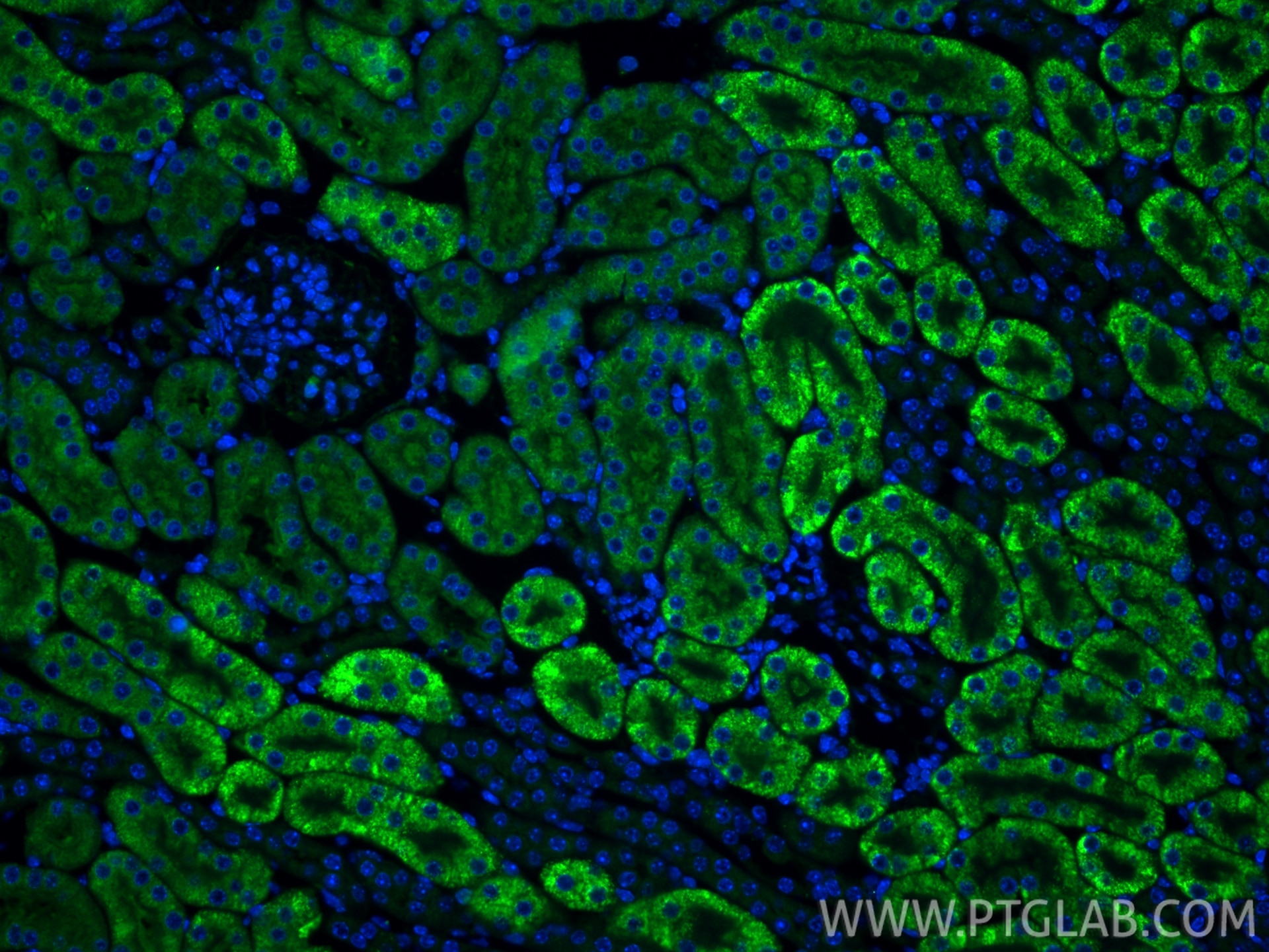 Immunofluorescence (IF) / fluorescent staining of mouse kidney tissue using TSG-6 Polyclonal antibody (13321-1-AP)