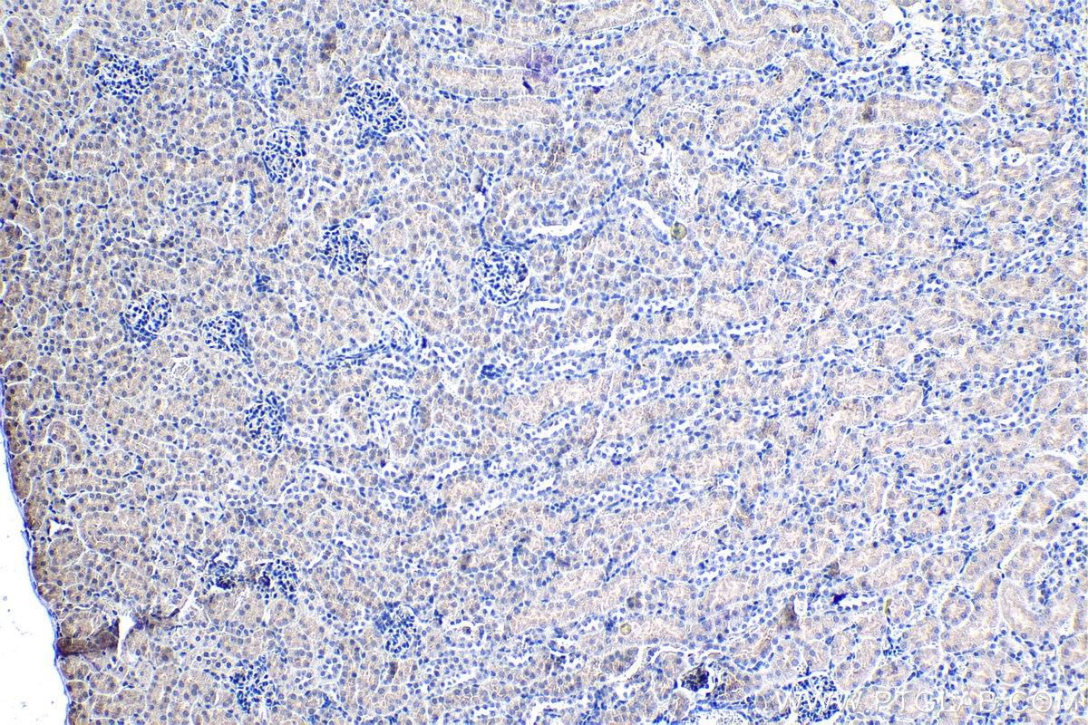 Immunohistochemistry (IHC) staining of mouse kidney tissue using TSG-6 Polyclonal antibody (13321-1-AP)