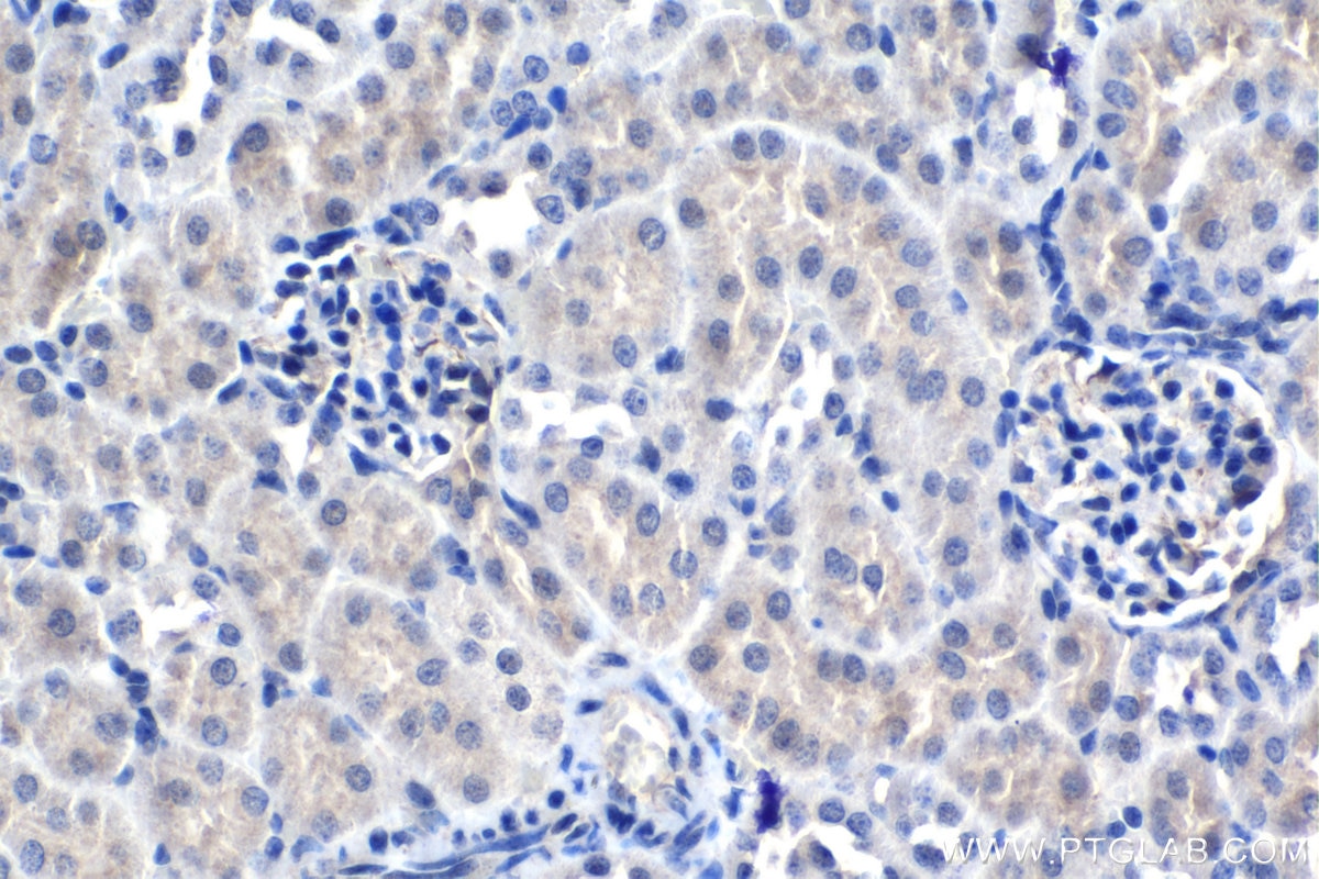IHC staining of mouse kidney using 13321-1-AP