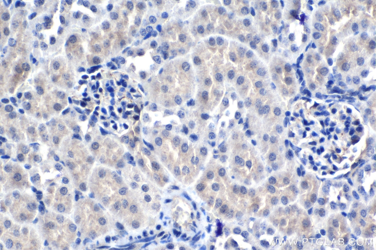 Immunohistochemistry (IHC) staining of mouse kidney tissue using TSG-6 Polyclonal antibody (13321-1-AP)