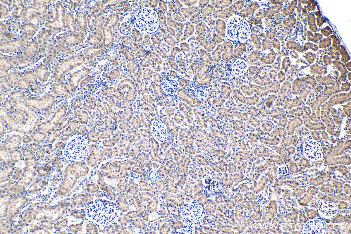 Immunohistochemistry (IHC) staining of rat kidney tissue using TSG-6 Polyclonal antibody (13321-1-AP)