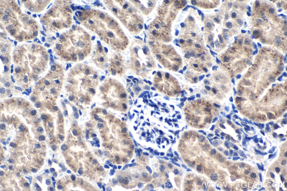 Immunohistochemistry (IHC) staining of rat kidney tissue using TSG-6 Polyclonal antibody (13321-1-AP)
