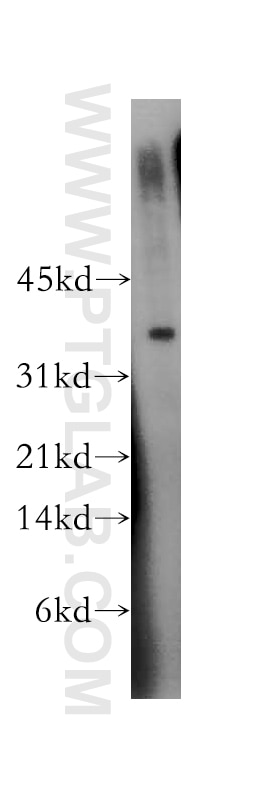 Western Blot (WB) analysis of A549 cells using TSG-6 Polyclonal antibody (13321-1-AP)