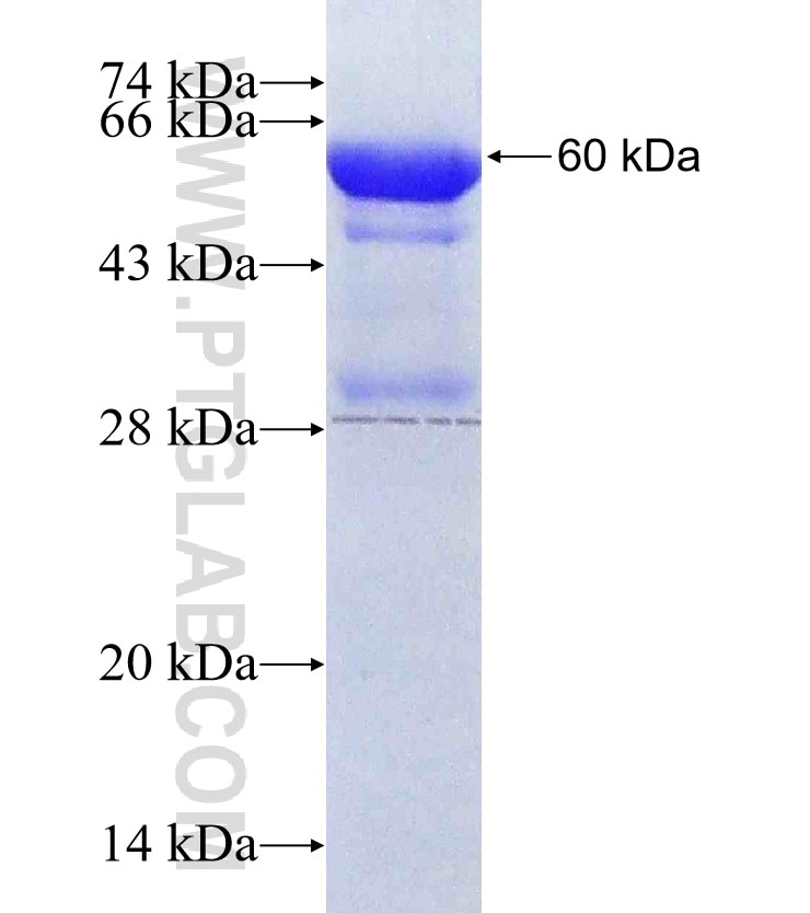 TNFAIP6 fusion protein Ag3885 SDS-PAGE