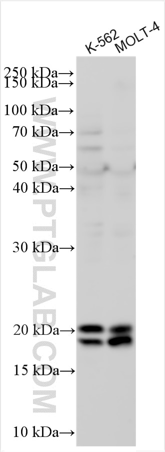 Western Blot (WB) analysis of various lysates using TNFAIP8 Polyclonal antibody (15790-1-AP)