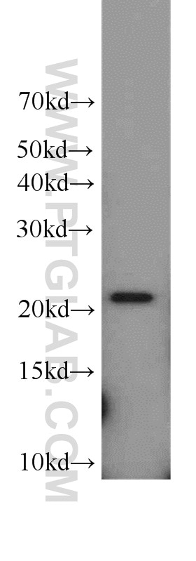 Western Blot (WB) analysis of A549 cells using TNFAIP8 Polyclonal antibody (15790-1-AP)