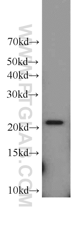 WB analysis of A549 using 15790-1-AP