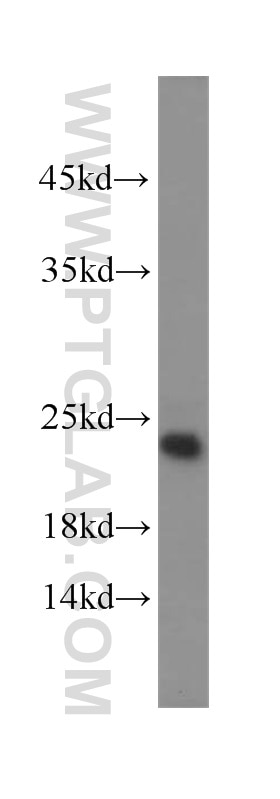 Western Blot (WB) analysis of PC-13 cells using TNFAIP8 Polyclonal antibody (15790-1-AP)