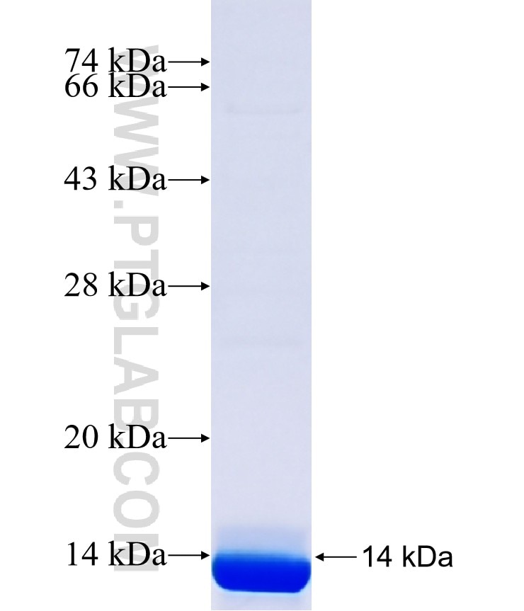 TNFAIP8 fusion protein Ag41446 SDS-PAGE TNFAIP8 fusion protein Ag41446 SDS-PAGE