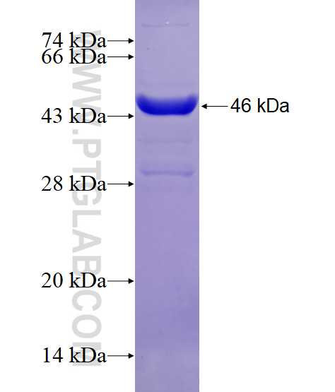 TNFAIP8 fusion protein Ag8491 SDS-PAGE