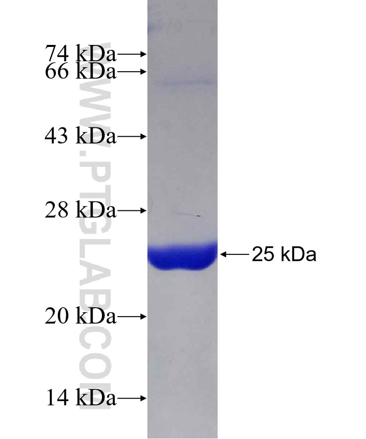 TNFAIP8 fusion protein Ag8805 SDS-PAGE