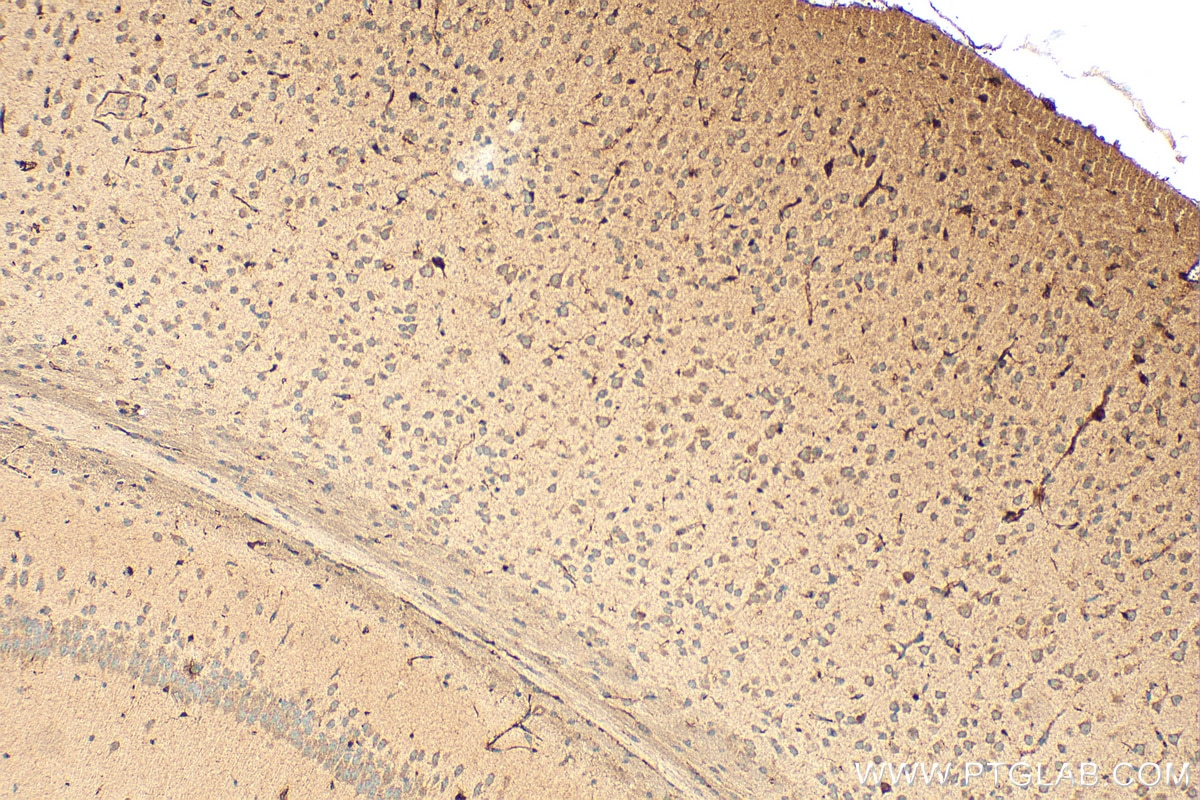 Immunohistochemistry (IHC) staining of mouse brain tissue using TNFAIP8L1 Polyclonal antibody (17366-1-AP)