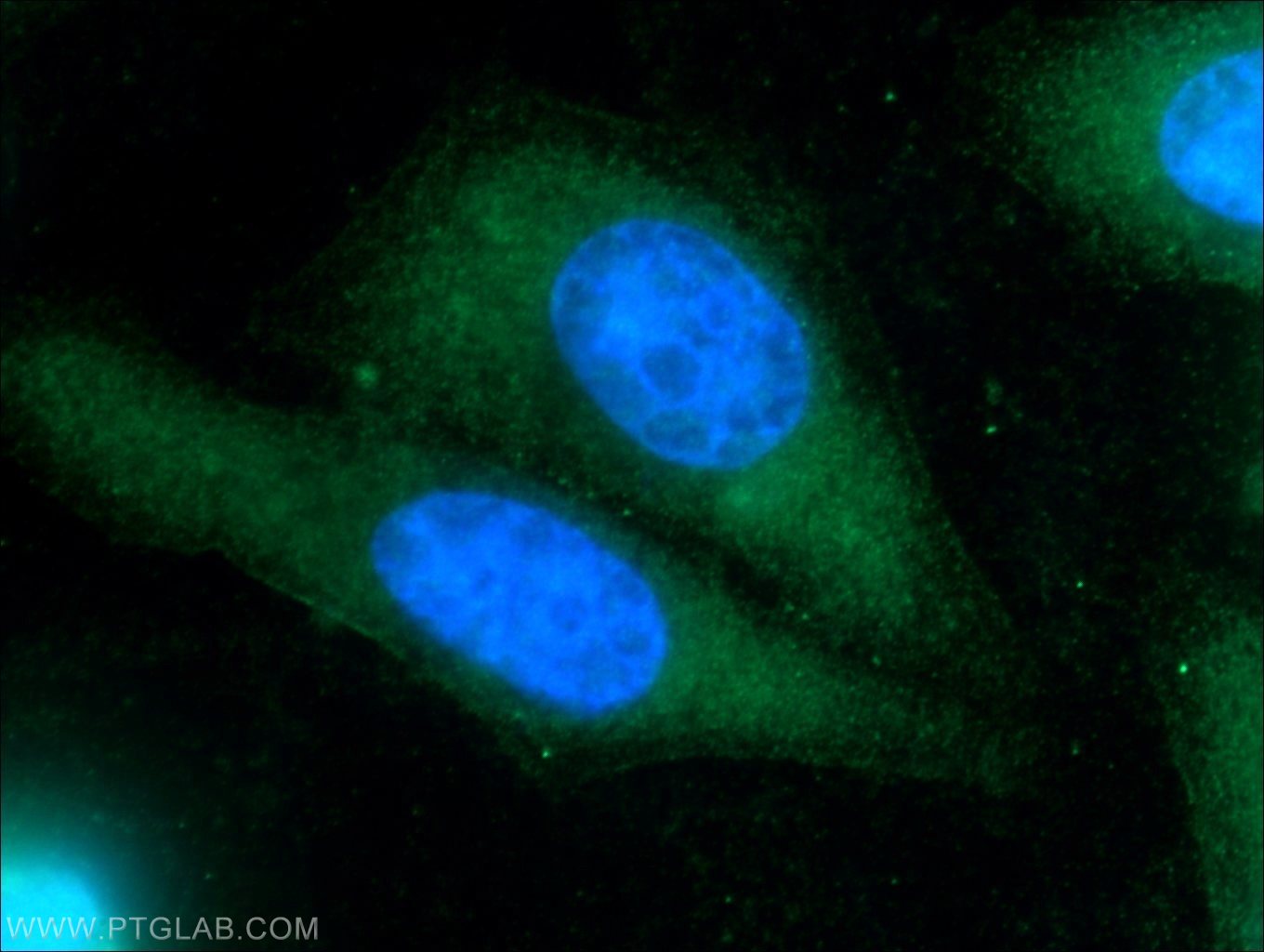 Immunofluorescence (IF) / fluorescent staining of HepG2 cells using TNFAIP8L2 Polyclonal antibody (15940-1-AP)