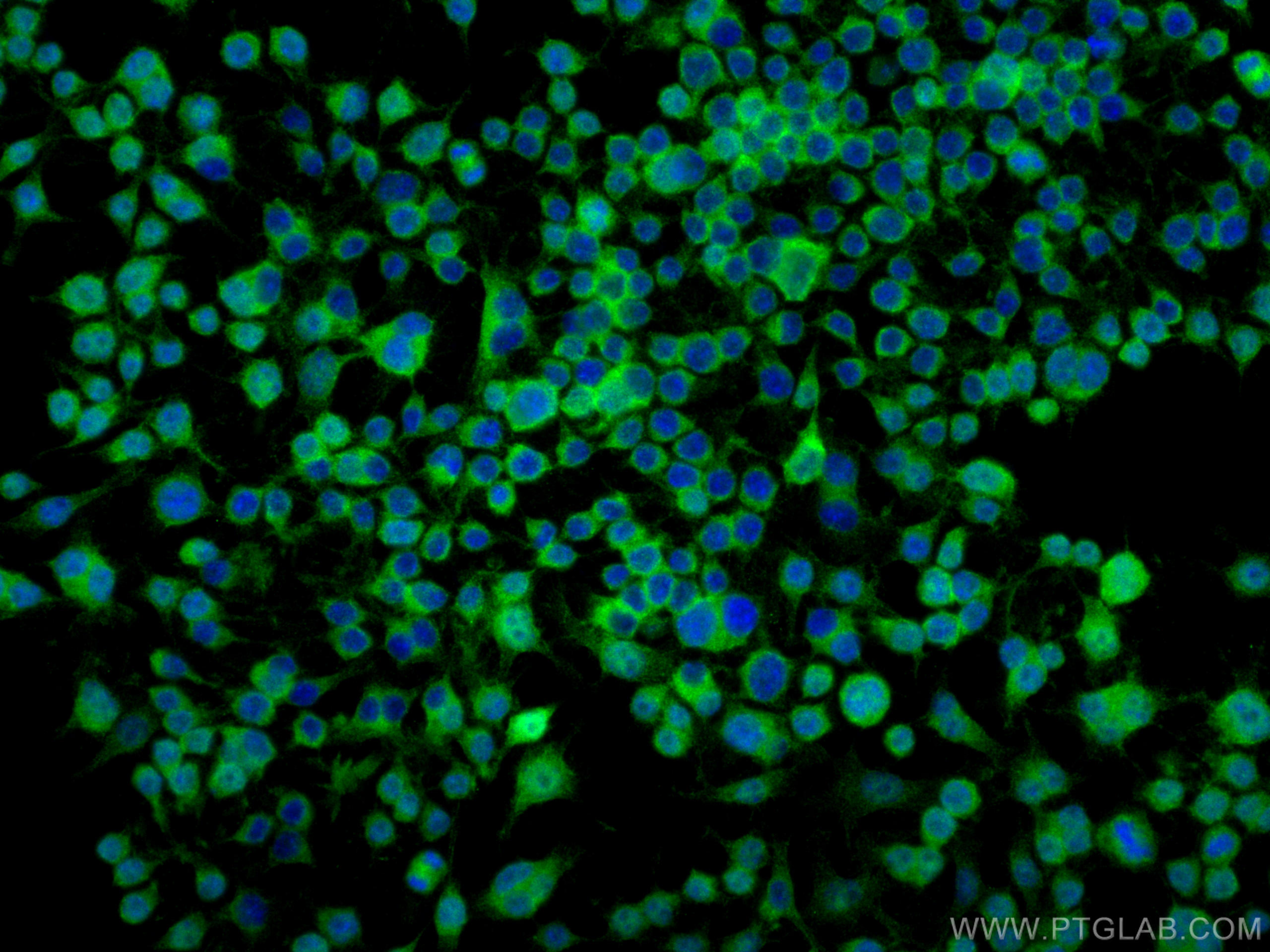 Immunofluorescence (IF) / fluorescent staining of RAW 264.7 cells using TIPE2 Polyclonal antibody (15940-1-AP)