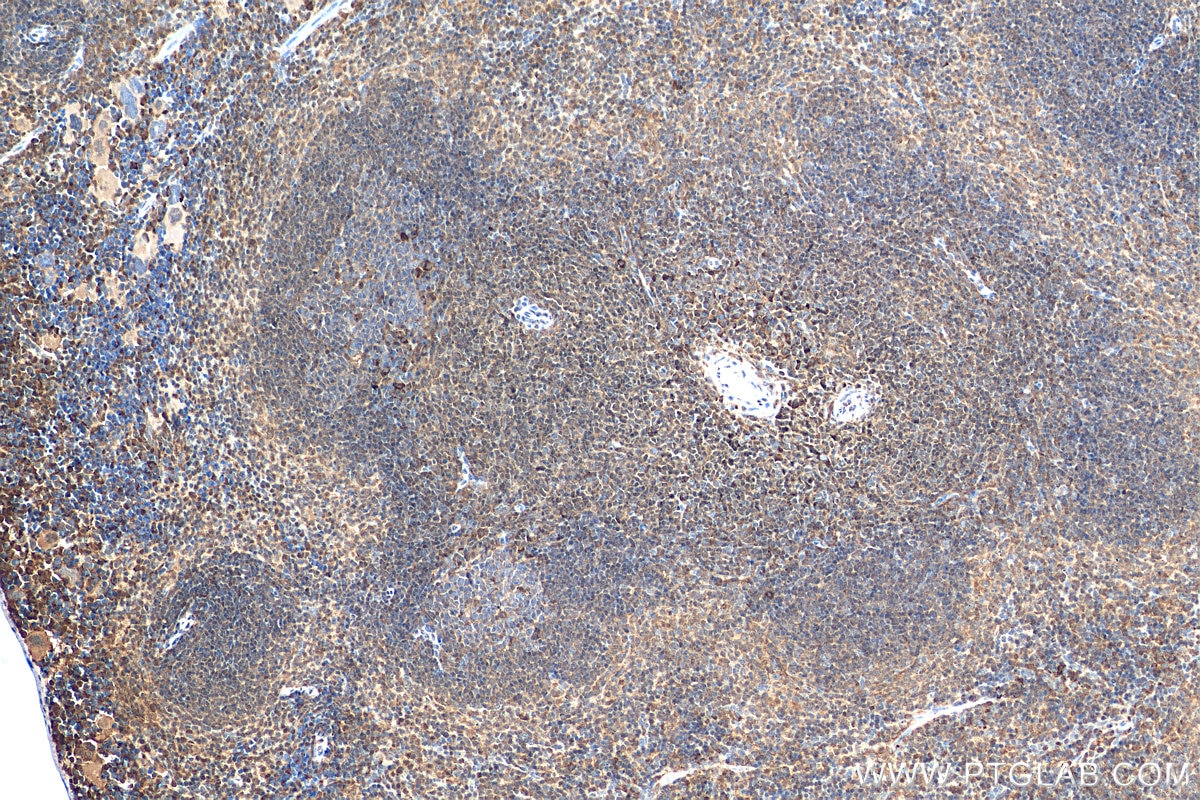 Immunohistochemistry (IHC) staining of mouse spleen tissue using TIPE2 Polyclonal antibody (15940-1-AP)