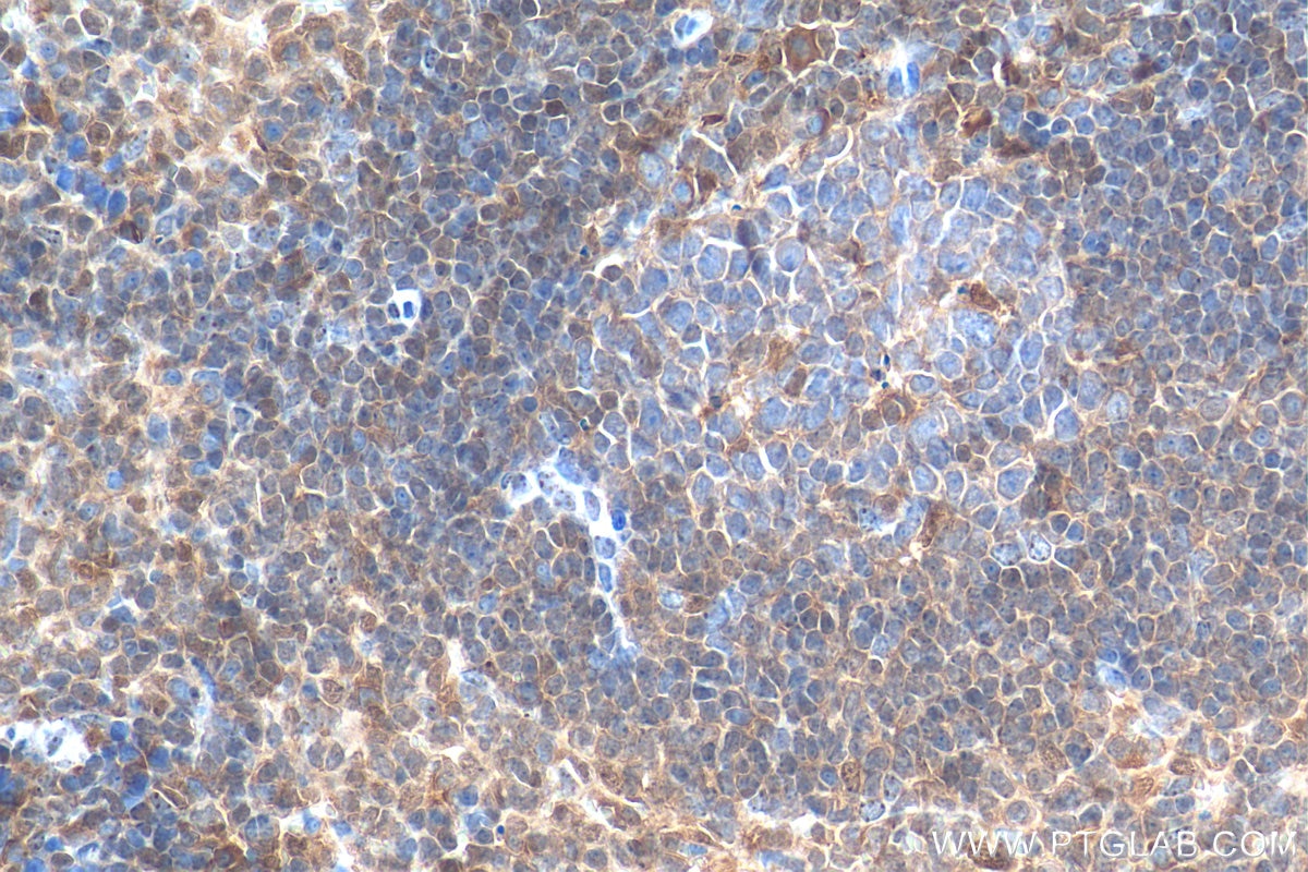 Immunohistochemistry (IHC) staining of mouse spleen tissue using TIPE2 Polyclonal antibody (15940-1-AP)