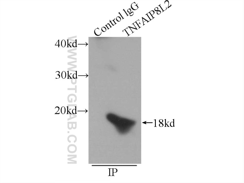 Immunoprecipitation (IP) experiment of mouse cerebellum tissue using TIPE2 Polyclonal antibody (15940-1-AP)