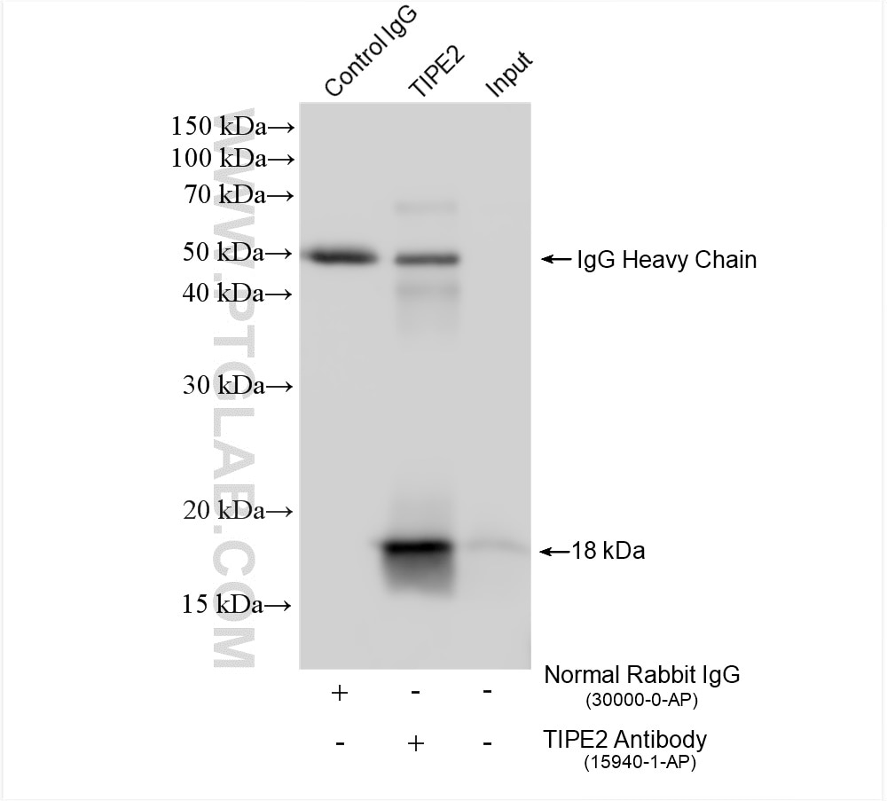 Immunoprecipitation (IP) experiment of mouse spleen tissue using TIPE2 Polyclonal antibody (15940-1-AP)